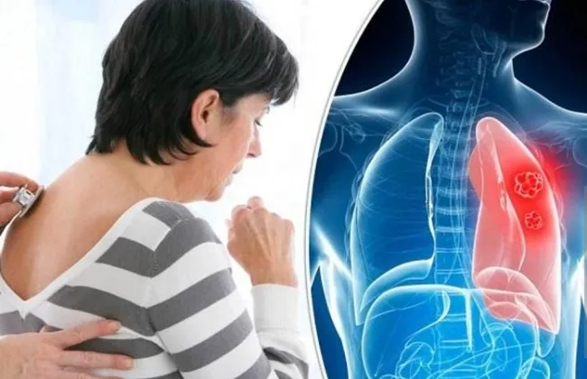 يوم الرئة العالمى.. أضرار غير متوقعة لمعطرات الجو على الأطفال 