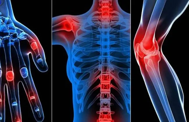 لماذا تزداد آلام المفاصل في الشتاء؟ أسباب وحلول بسيطة