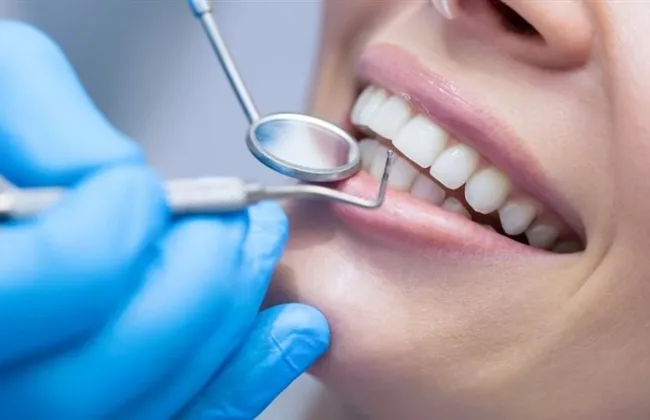 طرق منزلية فعالة لعلاج حساسية الأسنان