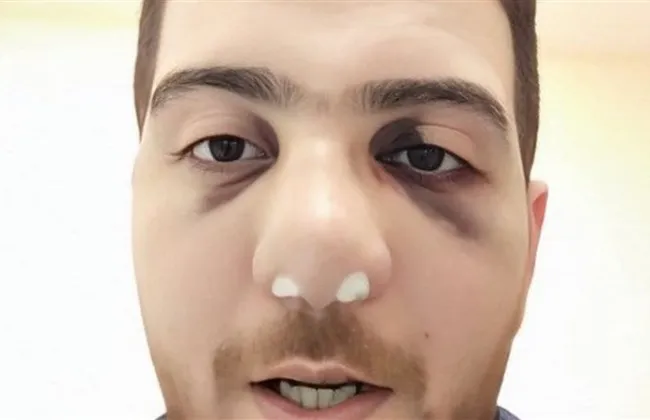 كاميرات المراقبة تكشف حقيقة واقعة مستشفى الباجور بالمنوفية