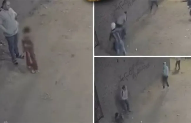 الحقيقة حول بتر ساق الطفل محمد