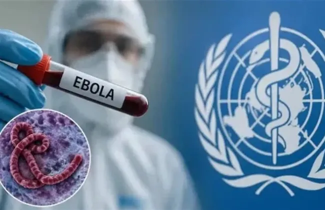 الصحة العالمية: إصابة 75 طبيبا بفيروس إيبولا.. ووفاة 17 منهم بالكونغو