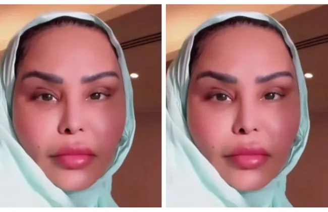 رحلة الفنانة أحلام مع التجميل تتواصل من الأنف إلى شد الوجه